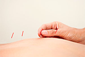 a-drug-free-option-for-work-injuries-2